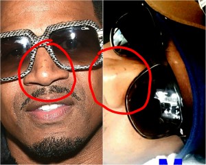 The man in Ms. Jackson's Snapchat photo (LEFT) has acne on the form of 2 bumps on his nose, as does Stevie.