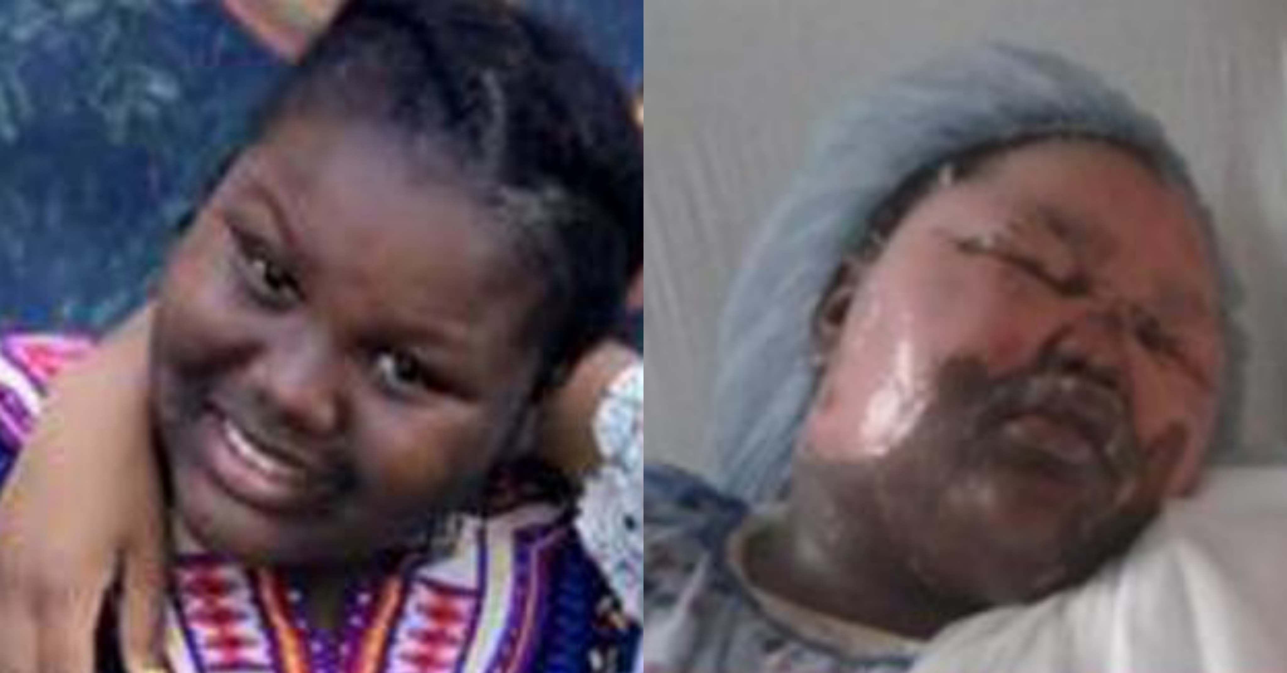 11 year old burn bronx jamoneisha merritt